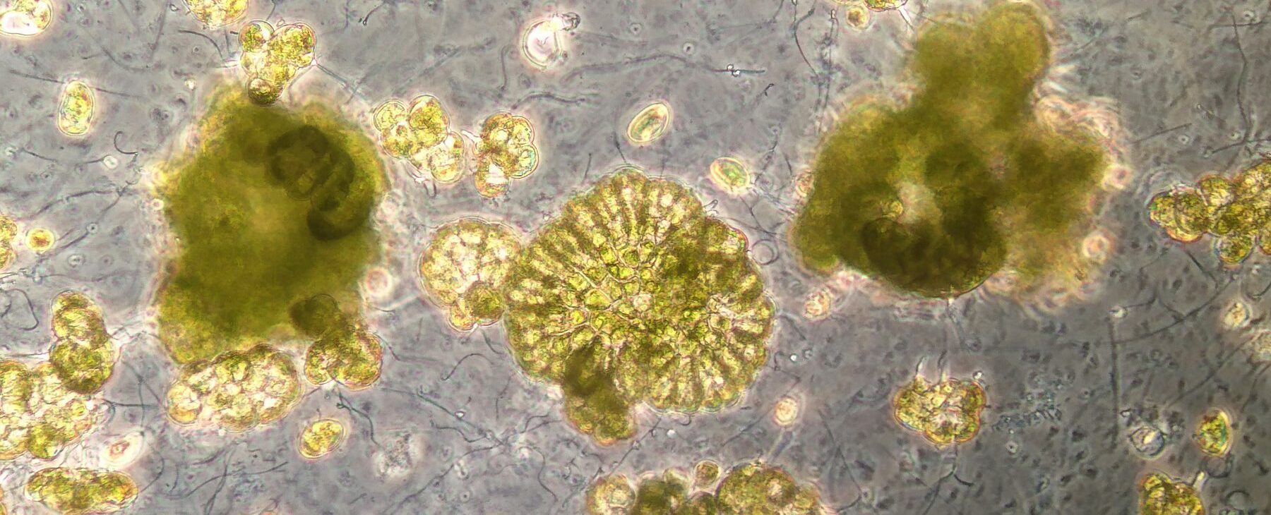 Microscope photo of algae.